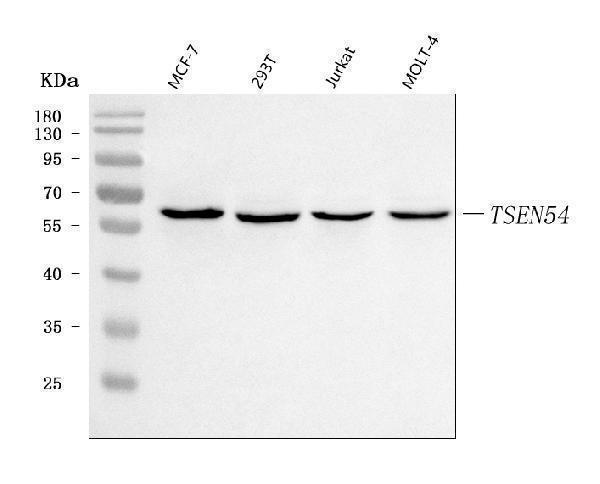  Western blot analysis of TSEN54 using anti-TSEN54 antibody (A07022-2)
