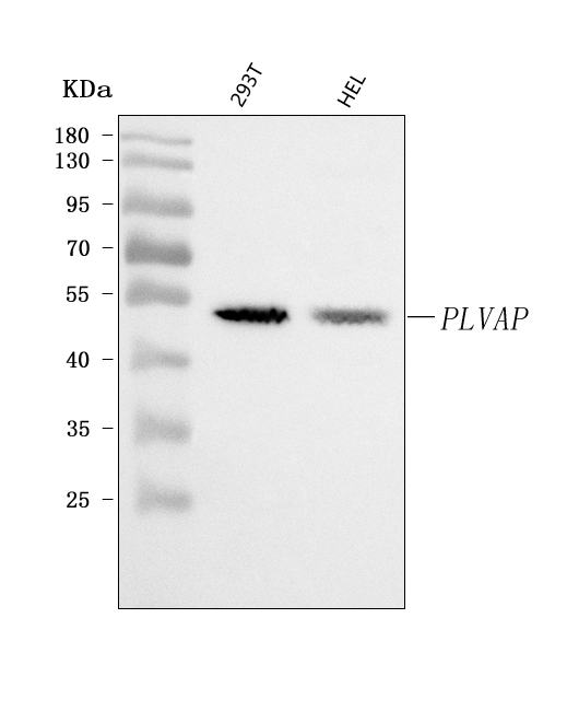  Western blot analysis of PLVAP using anti-PLVAP antibody (A07024)