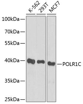 a07025 1 polr1c primary antiboties wb testing 1