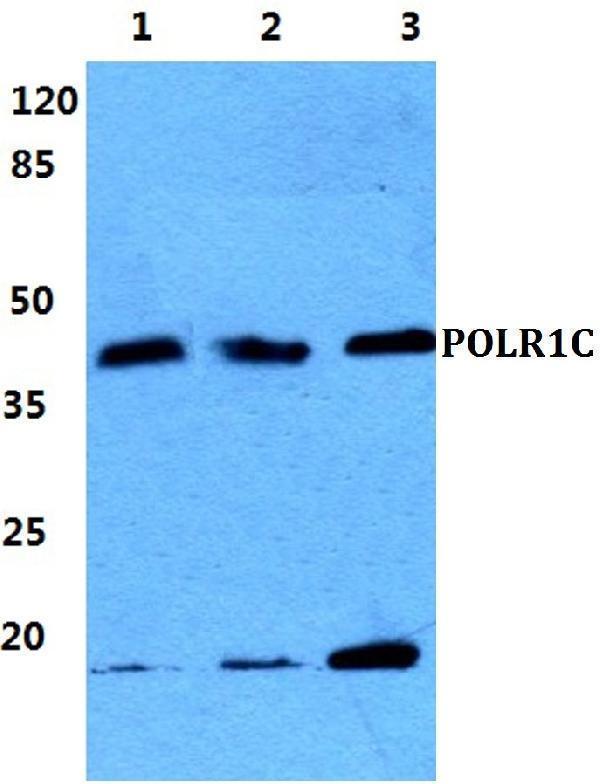 a07025 polr1c primary antiboties wb testing 1