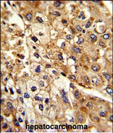 a07027 1 anti atp1b2 antibody center ihc p testing 2