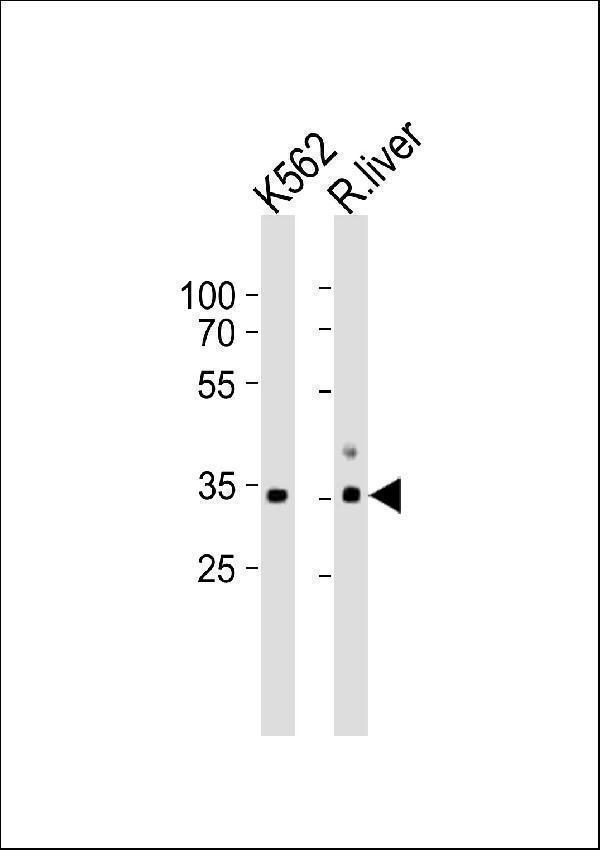 a07027 1 anti atp1b2 antibody center wb testing 1