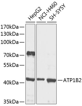 a07027 atp1b2 primary antiboties wb testing 1