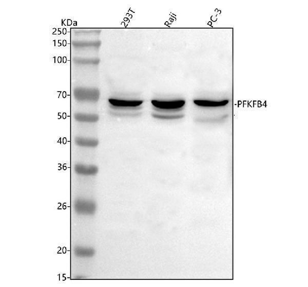  Western blot analysis of PFKFB4 using anti-PFKFB4 antibody (A07028-1)