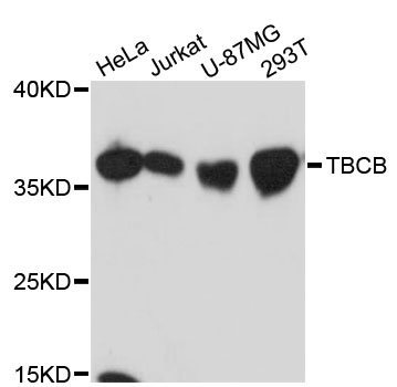 Western blot analysis of extracts of various cell lines, using TBCB antibody at 1:3000 dilution