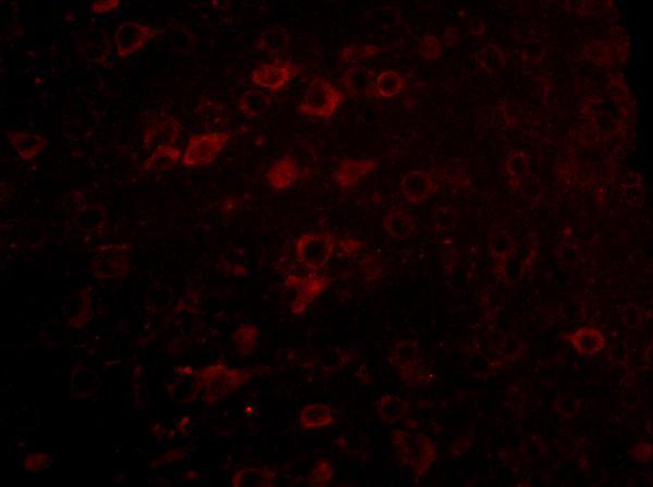 Immunofluorescence of LASS6 in Mouse Brain cells with LASS6 antibody at 5 μg/mL