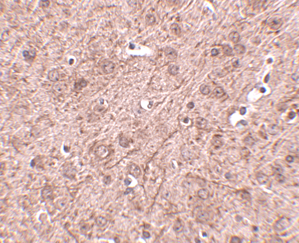 Immunohistochemistry of LASS6 in mouse brain tissue with LASS6 antibody at 2