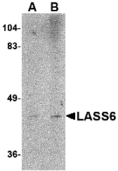 Western blot analysis of LASS6 in rat brain tissue lysate with LASS6 antibody at (A) 1 and (B) 2 μg/mL