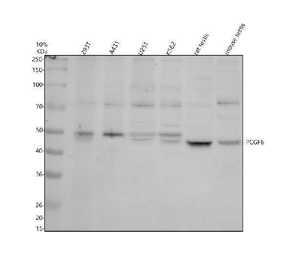 Western blot analysis of PCGF6 using anti-PCGF6 antibody (A07034-2)