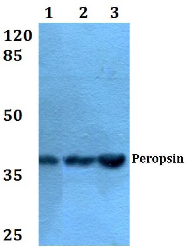 a07038 1 rrh primary antiboties wb testing 1
