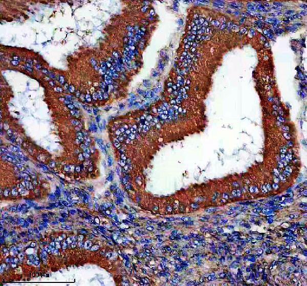 IHC analysis of EIF3M using anti-EIF3M antibody (A07041-1)