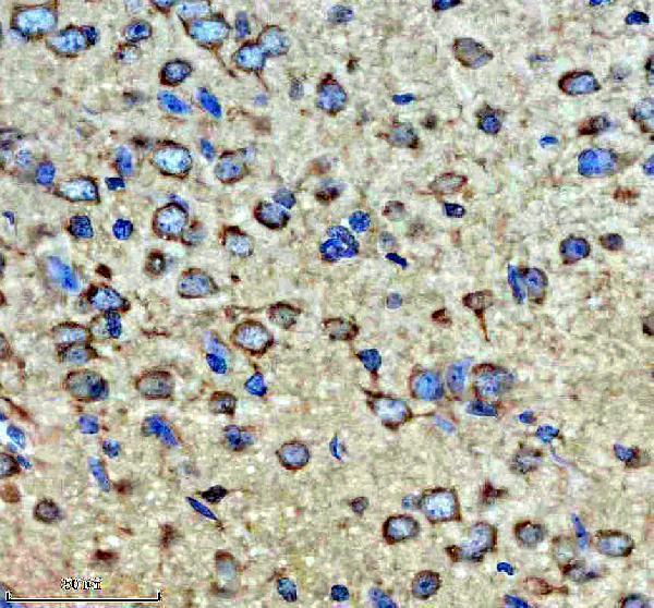 IHC analysis of EIF3M using anti-EIF3M antibody (A07041-1)