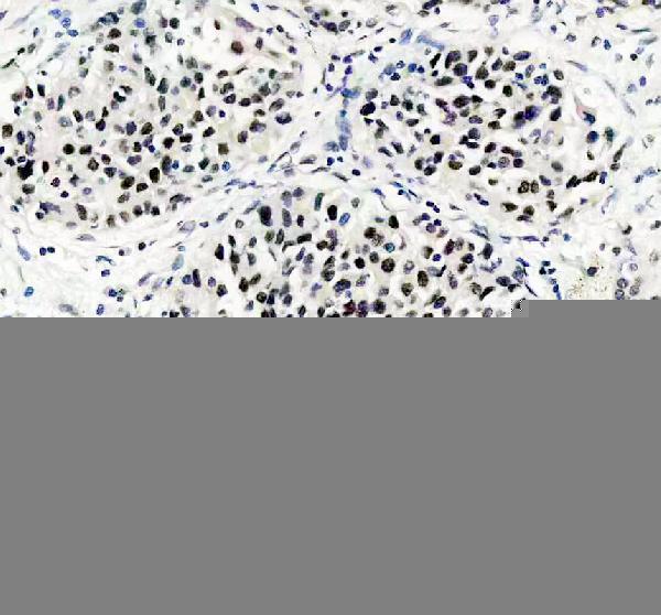 IHC analysis of RALY using anti-RALY antibody (A07043-4)