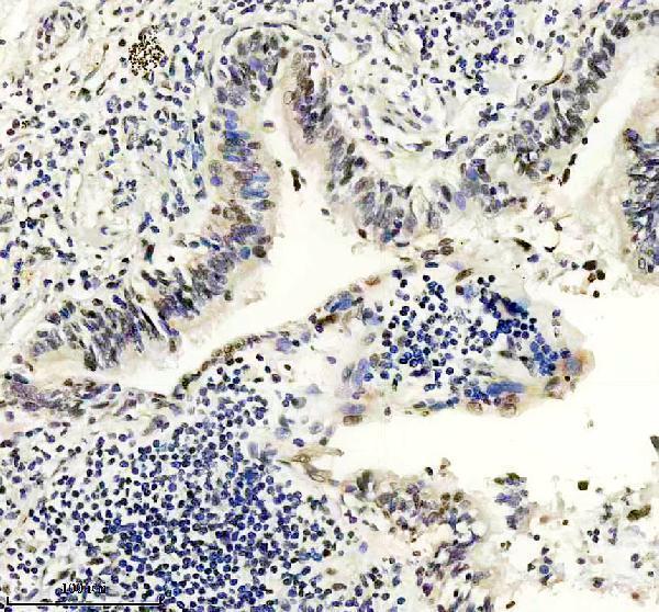 IHC analysis of RALY using anti-RALY antibody (A07043-4)