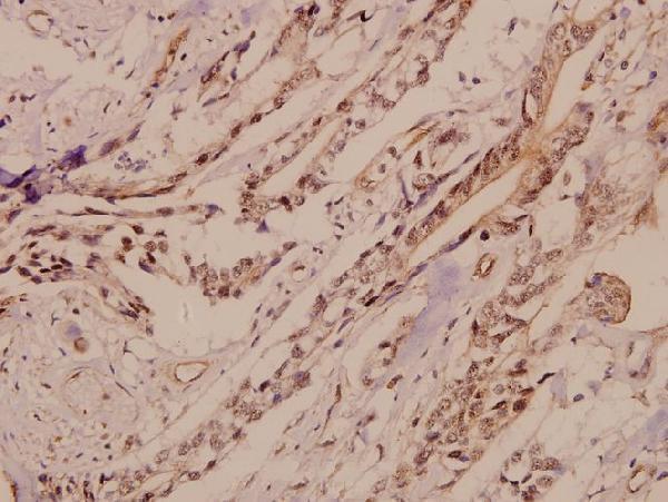 a07044 gria4 primary antiboties ihc testing 2