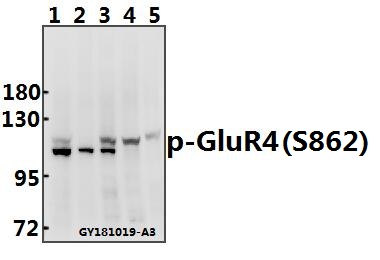 a07044s862 gria4 primary antiboties wb testing 1