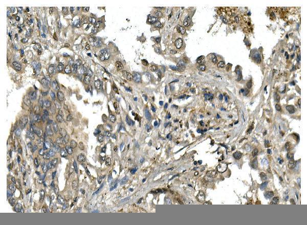 a07046 1 mesp2 primary antibodies ihc testing 2