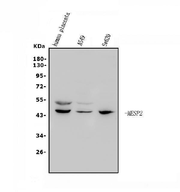 a07046 1 mesp2 primary antibodies wb testing 1