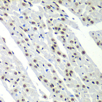a07047 sf3b2 primary antiboties ihc testing 2