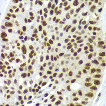 a07047 sf3b2 primary antiboties ihc testing 3