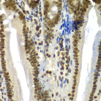 a07047 sf3b2 primary antiboties ihc testing 4