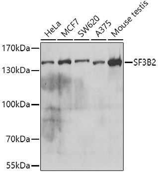 a07047 sf3b2 primary antiboties wb testing 1