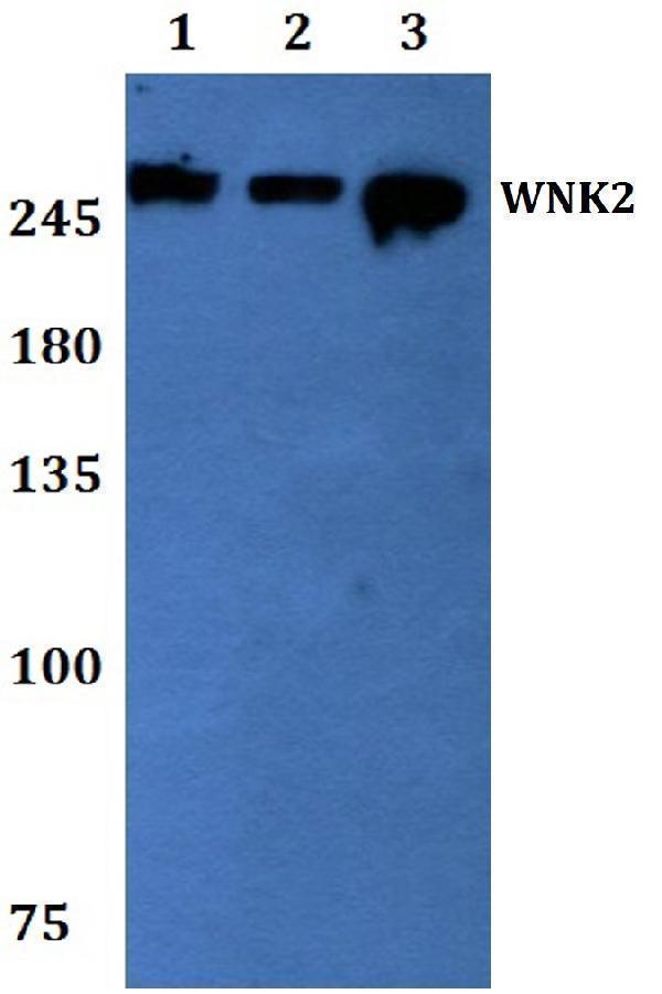 Western blot (WB) analysis of WNK2 polyclonal antibody at 1:500 dilution
Lane1:Hela whole cell lysate
Lane2:sp2/0 whole cell lysate
Lane3:MCF-7 whole cell lysate