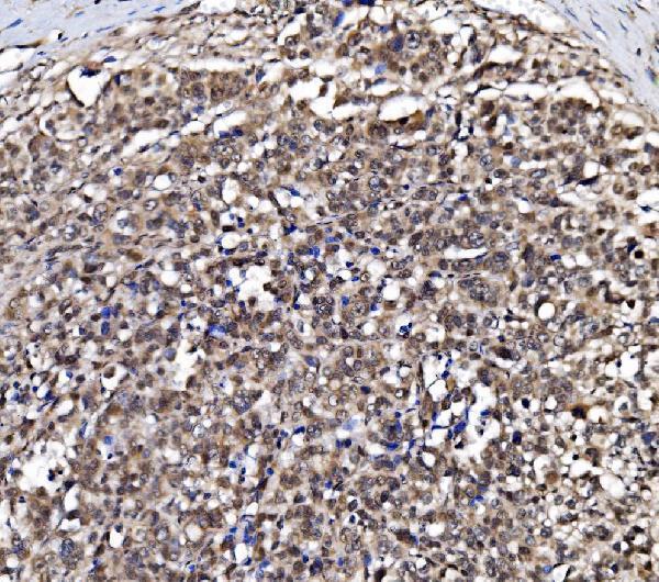  IHC analysis of NOLA1/GAR1 using anti-NOLA1/GAR1 antibody (A07049-1)