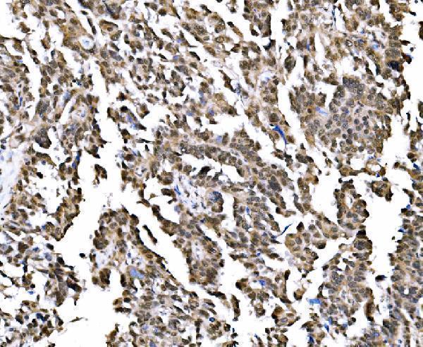 a07049 1 gar1 primary antibodies ihc testing 5