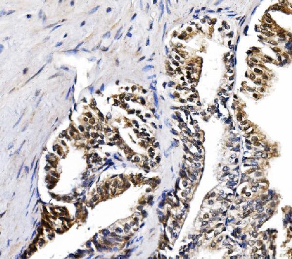 a07049 1 gar1 primary antibodies ihc testing 7
