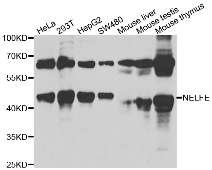 Immunohistochemistry of paraffin-embedded rat pancreas using NELFE Rabbit pAb  at dilution of 1:100 