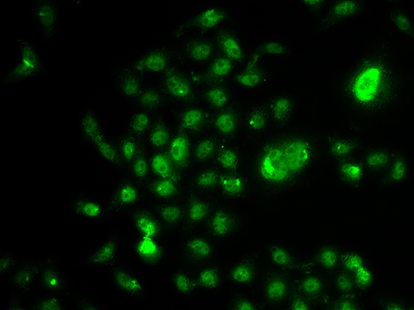 Immunohistochemistry of paraffin-embedded human esophageal using NELFE Rabbit pAb  at dilution of 1:100 