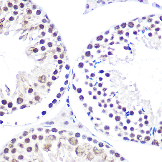 a07050 nelfe primary antiboties ihc testing 4