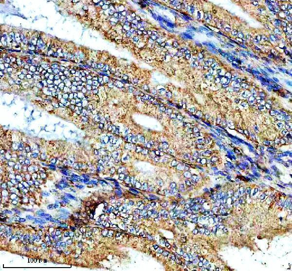 IHC analysis of NTN4 using anti-NTN4 antibody (A07052-1)