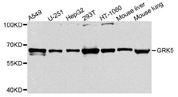 Western blot analysis of extracts of Mouse liver tissue, using GPX7 antibody