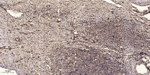 Immunohistochemical analysis of paraffin-embedded human oophoroma