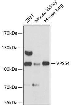 Western blot analysis of extracts of various cell lines, using VPS54 antibody  at 1:3000 dilution