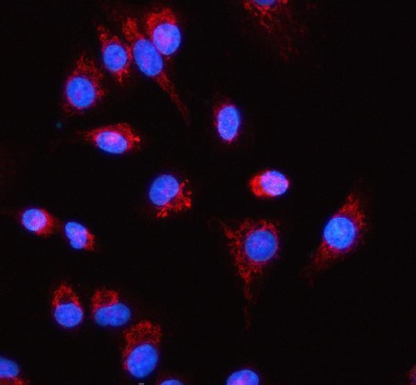 a07057 3 rpl18 primary antibodies if testing 9