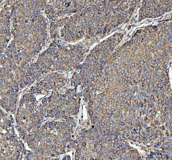 a07057 3 rpl18 primary antibodies ihc testing 2