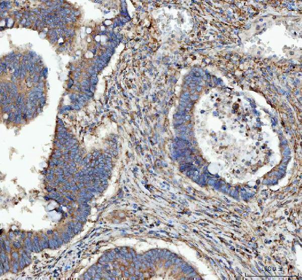 a07057 3 rpl18 primary antibodies ihc testing 4