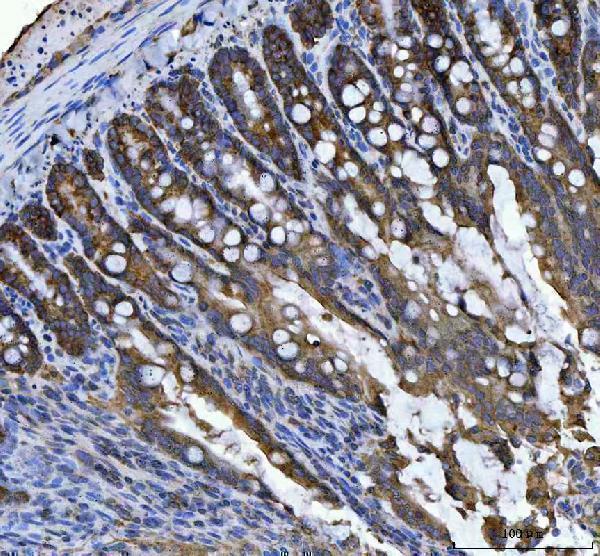 a07057 3 rpl18 primary antibodies ihc testing 8