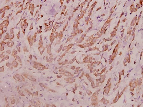 a07057 rpl18 primary antiboties ihc testing 2