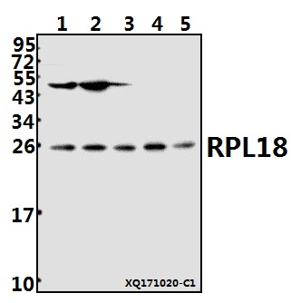 a07057 rpl18 primary antiboties wb testing 1