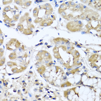 Immunohistochemistry analysis of paraffin-embedded human stomach using IFNL1 antibody at dilution of 1:100 (40x lens)