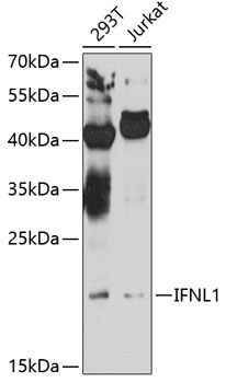 Western blot analysis of extracts of various cell lines, using IFNL1 antibody at 1:1000 dilution