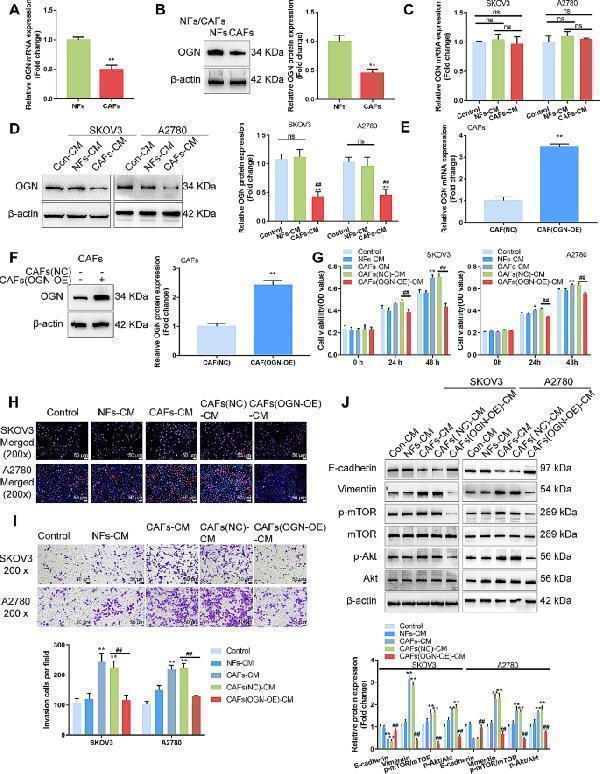 Culture with OGN-overexpressing CAFs-derived conditioned medium inhibits ovarian cancer cell aggressiveness ( A – B ) The mRNA expression and protein levels of OGN were examined in CAFs and NFs by qRT-PCR and Immunoblotting, respectively