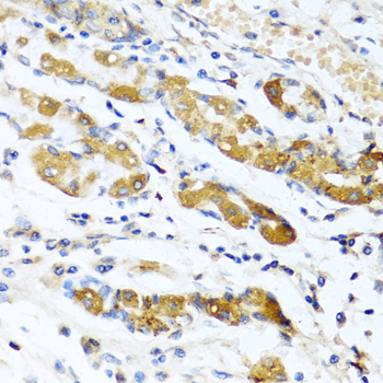 Immunohistochemistry of paraffin-embedded rat brain using OGN antibody at dilution of 1:100 (40x lens)