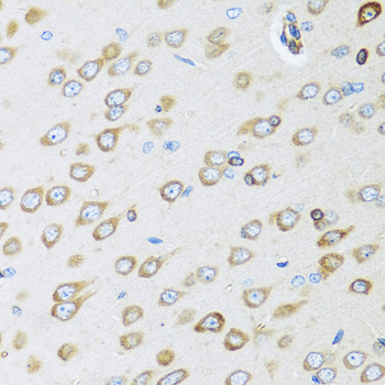 Immunohistochemistry of paraffin-embedded human stomach using OGN antibody at dilution of 1:100 (40x lens)