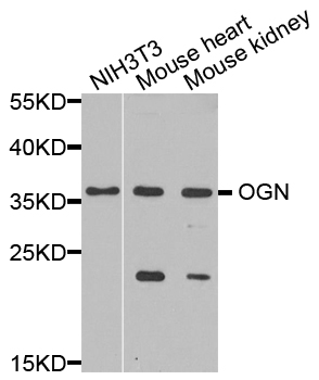 Western blot analysis of extracts of various cell lines, using OGN antibody
