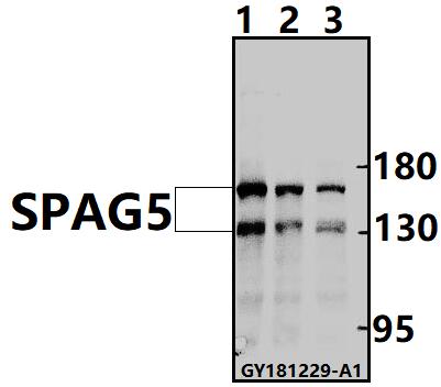 a07062 spag5 primary antiboties wb testing 1